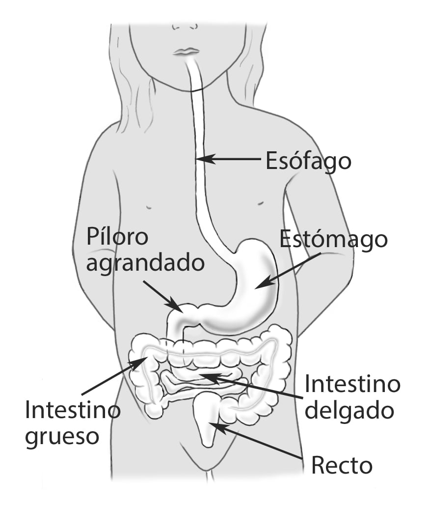 pyloric s-stomach-peds